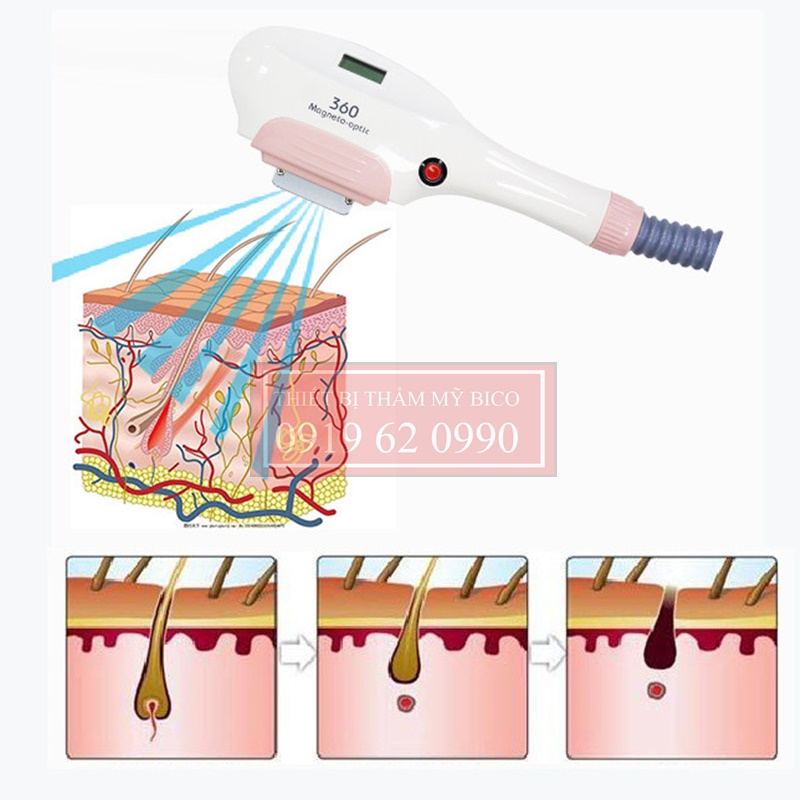 Máy triệt lông 2 tay cầm FQ3 chính hãng