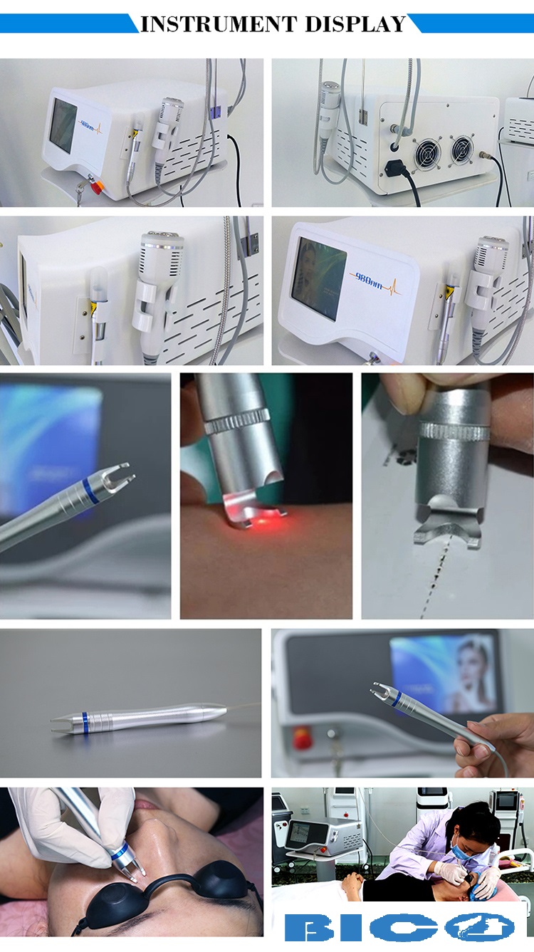 Hình ảnh Máy Laser Điều Trị Giãn Mao Mạch Laser