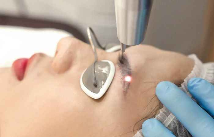 Laser Picosure là công nghệ xóa xăm hiện đại nhất hiện nay