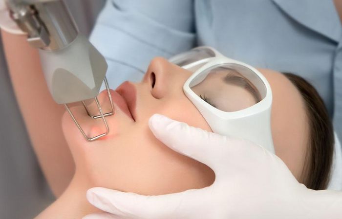 Thông số kỹ thuật của máy trị sẹo rỗ laser Co2 Fractional