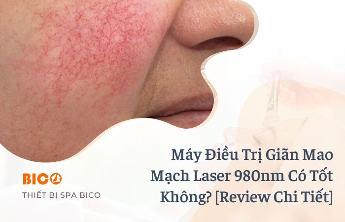 Máy Điều Trị Giãn Mao Mạch Laser 980nm Có Tốt Không? [Review Chi Tiết]