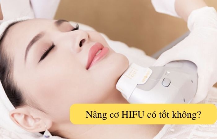 Nâng cơ HIFU có tốt không, có nên thực hiện không?