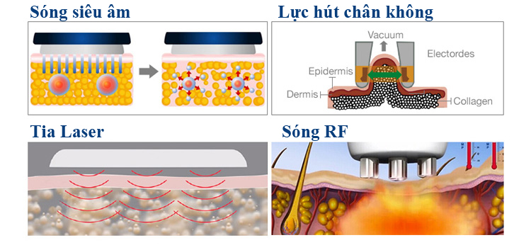 Máy Giảm Béo LS650 Laser Cavitation